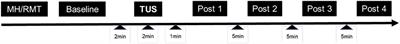 Increased Excitability Induced in the Primary Motor Cortex by Transcranial Ultrasound Stimulation